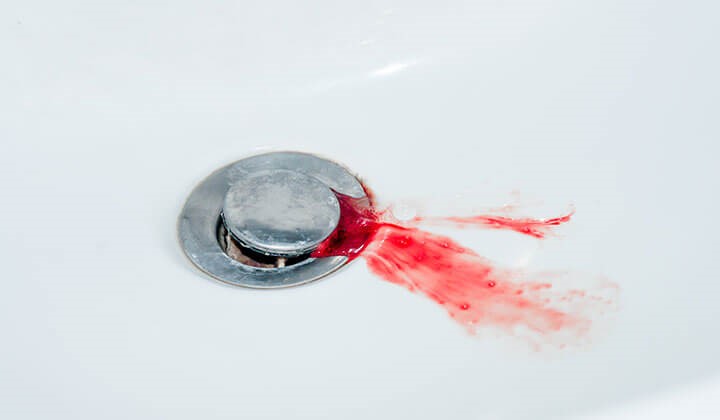 sink with blood Bleeding gums can have various causes