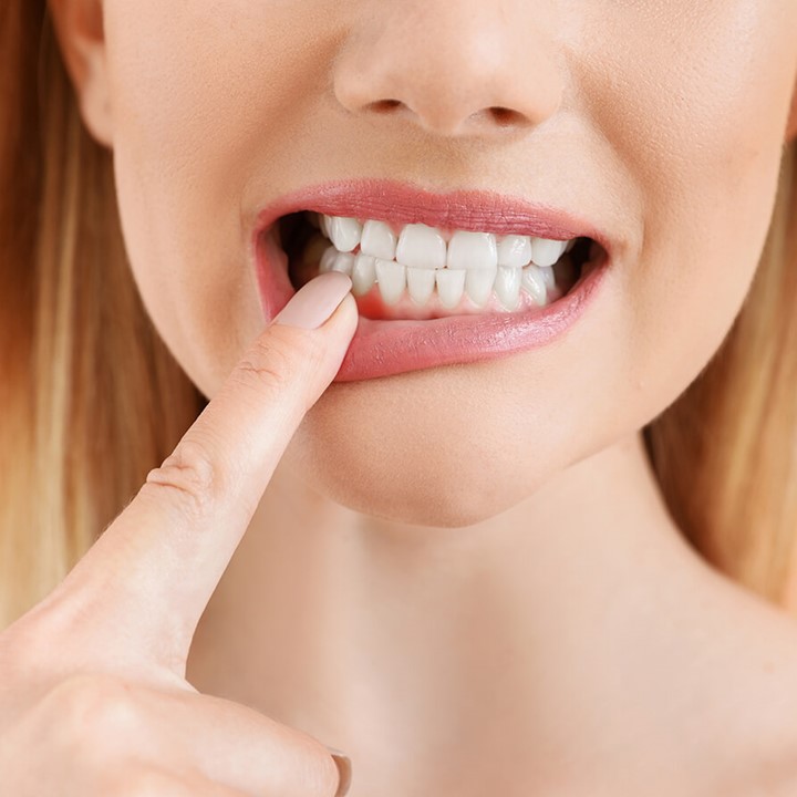 Woman checks gums Woman checks gums