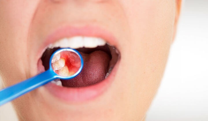 Problems with the oral mucosa Problems with the oral mucosa